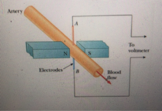 Artery To N S Electrodes Bloed llow
