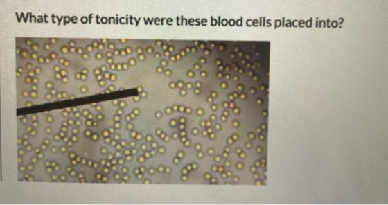 What type of tonicity were these blood cells placed into?