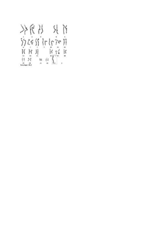 }} { } ៤ វ រ }{}{ ” } | 1111 Kary type: 45.X