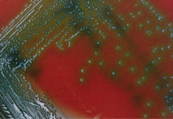 Image result for alpha strep on blood agar