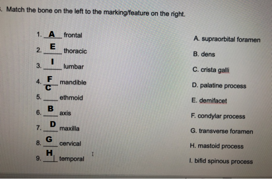 . Match the bone on the left to the marking/feature on the right. 1. A frontal E 2. thoracic A. supraorbital foramen B. dens