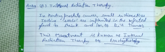 Ausy (Al Internal Radiation Therapy In treating prostate cancer, small radioactive, Iodine seeds are implanted in the infecte