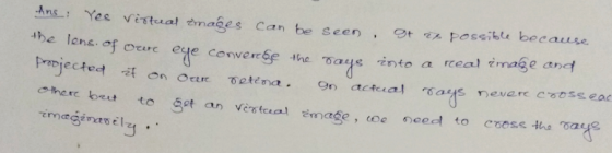Ans Yes Vittsal tmages can be seen, t he lens. Possible because ceerc eye converて6e -Ine TuS into a real rmageand a d