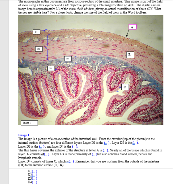 The micrographs in this document are from a cross-section of the small intestine. This image is part of the field of view usi