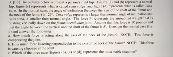 3. IL31 The pictures below represent a persons right hip. Figures (a) and (b) represent a normal hip, figure (c) represents