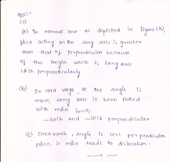 Anc In nomal One as depicted. in u ce acting on he on atis s greatery than that안 pe-pendicular becaus 이-the anate, which ts L