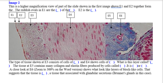 Image 2 This is a higher magnification view of part of the slide shown in the first image above.E1 and E2 together form the.