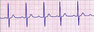 sal-ns-acls-300x103.png