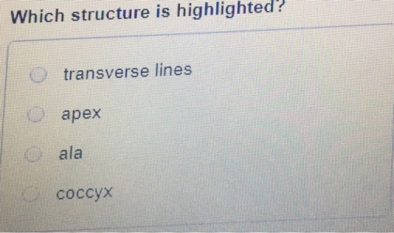 Which structure is highlighted? transverse lines apex ala coccyx