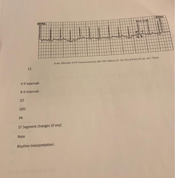 SYNC SYNC Pulse (10 sec an) 720pm Scale: 200ms/dw. I R-R Time (min/avemax): 826/839/846ms I St. Dec 6ms 12. P-P Intervals R-R
