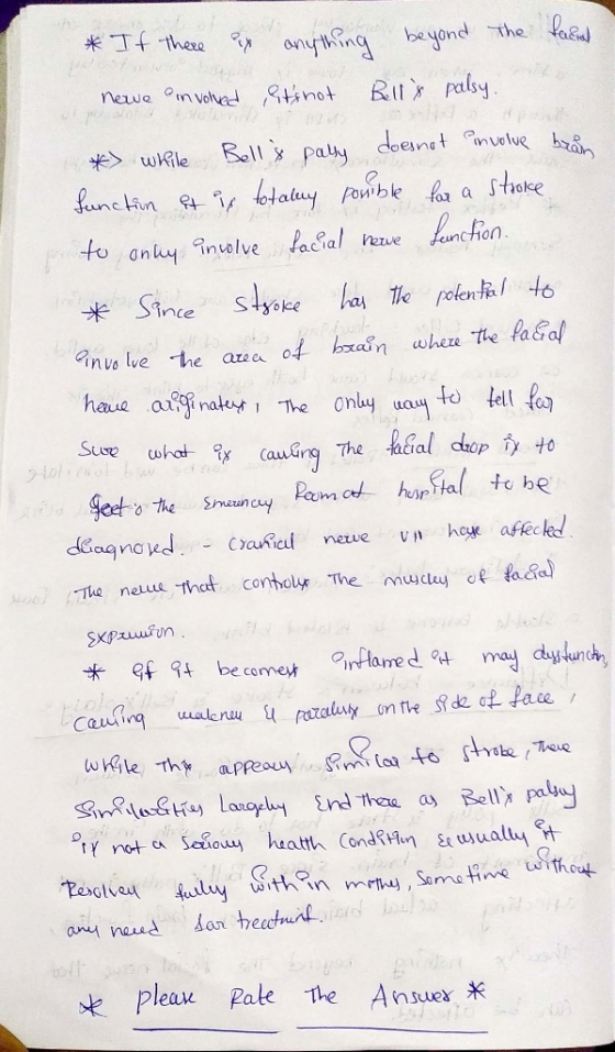 * If there ex anything beyond the facut newe envolved its not Bells palsy. * while Bells pally does not involue bran Sunct