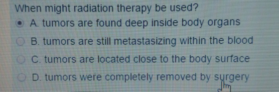 When might radiation therapy be used? © A. tumors are found deep inside body organs B. tumors are still metastasizing within