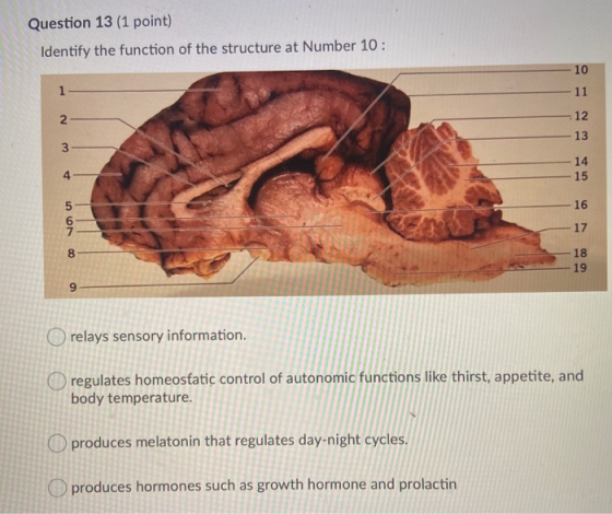 Question 13 (1 point) Identify the function of the structure at Number 10 : 10 1 11 2 12 13 3 14 15 4 16 vo 17 8 18 19 9 O re