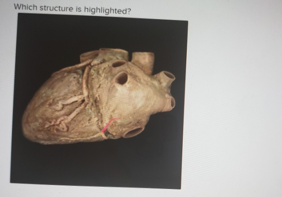 Which structure is highlighted?