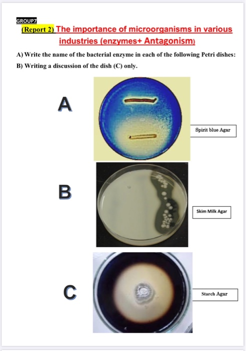 GROUP (Report 2) The importance of microorganisms in various industries (enzymes+ Antagonism) A) Write the name of the bacter