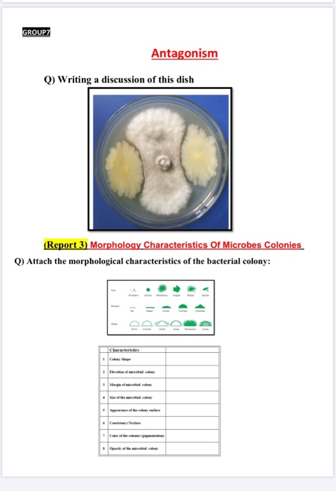 GROUP7 Antagonism Q) Writing a discussion of this dish (Report 3) Morphology Characteristics of Microbes Colonies Q) Attach t