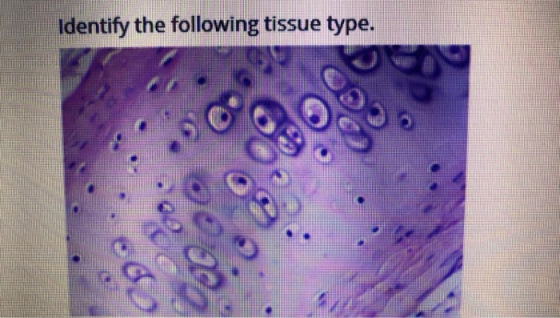 identify the following tissue type.