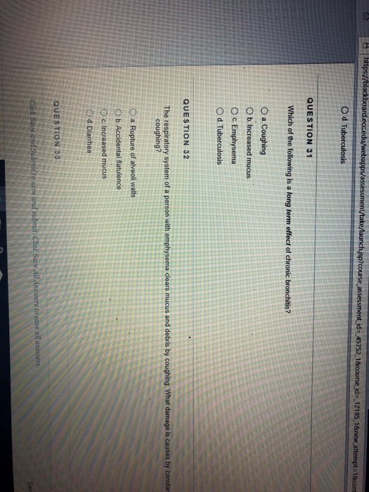 QUESTION 31 O a. Coughing O d Tuberculosis QUESTION 32 O b. Accidental flatulence QUESTION 33