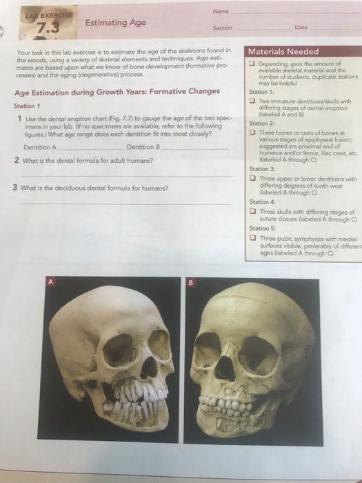 EXERcise Estimating Age Name Date Section Your task in this lab exercise is to estimate the age of the skeletons found in the