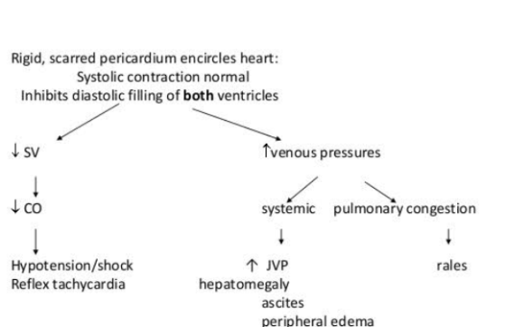 Rigid, scarred pericardium encircles heart: Systolic contraction normal Inhibits diastolic filling of both ventricles sv Tven