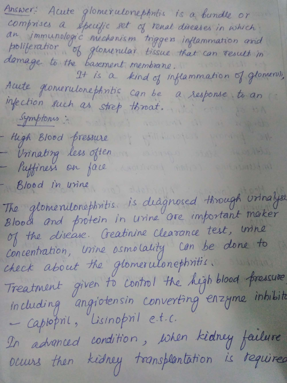 Ancver: Acute glonerulonephnbs is a bundle or comprises a ecelic got ronal diseases in which an immunologrić micka ni olilerahorisue that can reuth in damage to the basement membia nue s m tnggen inflammation and is a kind ot inylammation of lonr Muute gomerulonethnbs can be a responde t an infection Auch as step that Symptoms六 igh Blood presure Unnatrg ten Blood In uine Tho glomenilonethnitis is diagnosed hrough urinal Blood and protein in unine ore important mokei 여) the disease. Creatinine Cleano ance test, trn no Concentration, umne bsmo lality Can be done to check about t№ gemei utonephnti. Treatment given to Contol the hgh blood prescute in chuding angiotensin Converting enzyme inhlit Captopril, vlisinofil et-C aanad cordl tion on kidhey faibune ouwas then kidneれすronsplantation istequurea