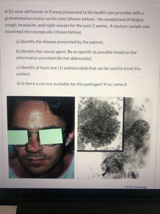 A 52-year old farmer in Fresno presented to his health care provider with a granulomatous lesion on his nose (shown below). H