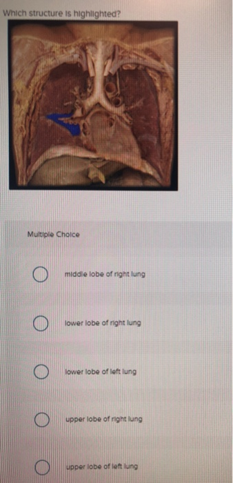 Which structure is highlighted? Multiple Choice middle lobe of right lung Ο lower lobe of right lung Ο lower lobe of left lun