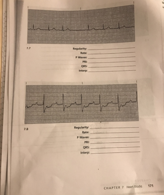 Regularity: Rate: P Waves: PRI: QRS: Interp: Regularity: Rate: P Waves: PRI: QRS: Interp: CHAPTER 7 Heart Blocks 171