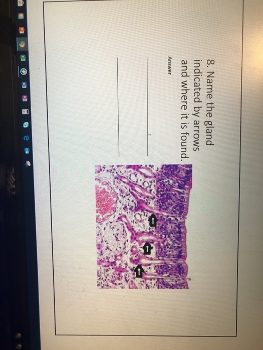 8. Name the gland indicated by arrows and where it is found, Answer