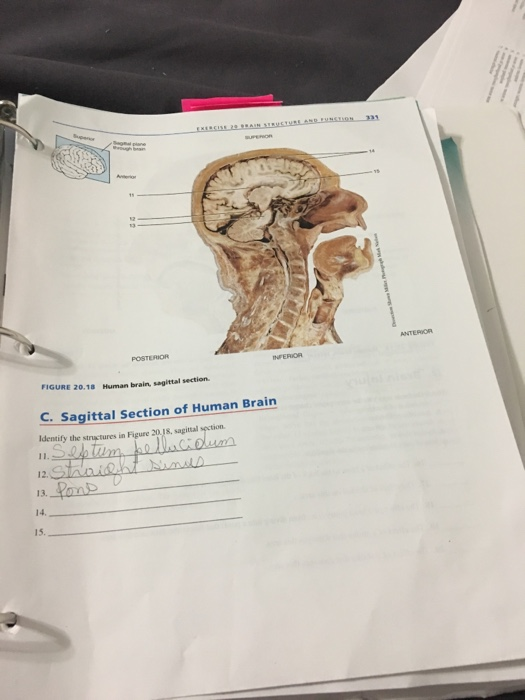 ANTERIOR POSTERIOR INFERIOR FIGURE 20.18 Human brain, sagittal section C. Sagittal Section of Human Brain Identify the struyc