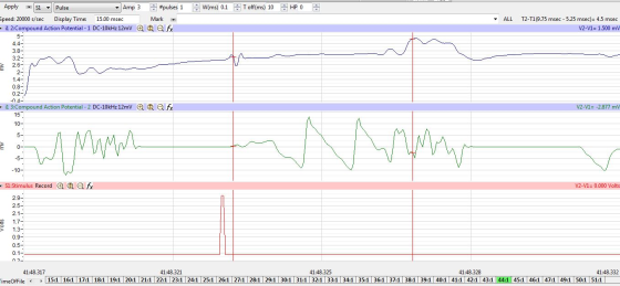 Please explain how to read the conduction velocity