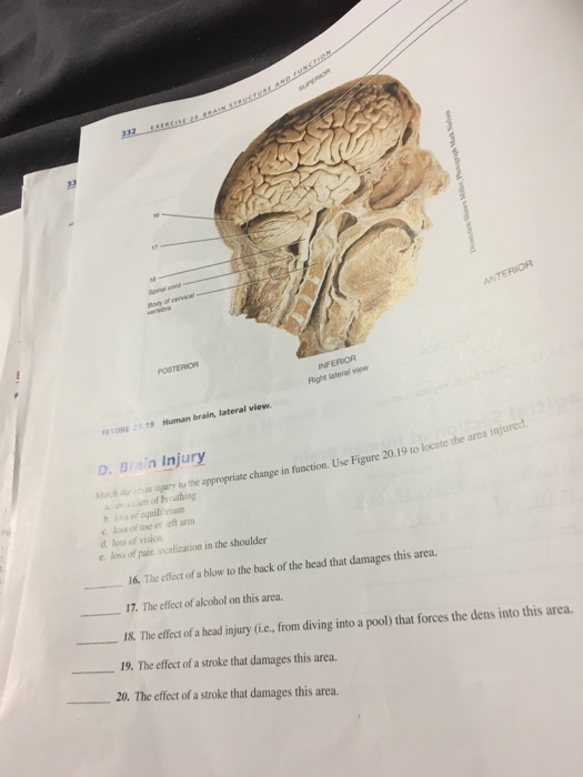INFERIOR Right lateral view SUE219 Human brain, lateral view D. Bain Injury nquo the appropriate change in function. Use Figu