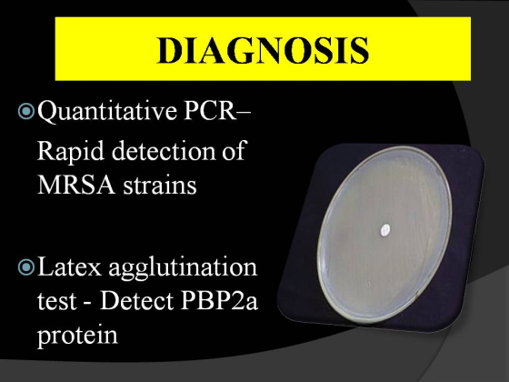 DIAGNOSIS O Quantitative PCR Rapid detection of MRSA strains o Latex agglutination test - Detect PBP2a protein