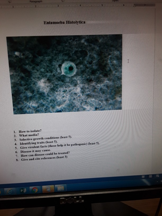 Paragraph Entamoeba Histolytica 1. How to isolate? 2. What media? 3. Selective growth conditions (least 5). 4. Identifying traits (least 5) 5. Give virulent facts 6. Disease it may cause. 7. How can disease could be treated? S. Give and cite references (least 3) (those help it be pathogenic) least 5)