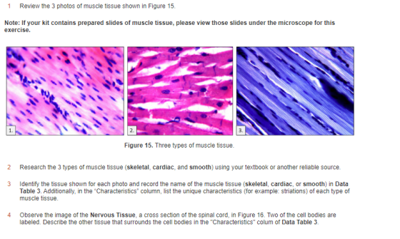 1 Review the 3 photos of muscle tissue shown in Figure 15. Note: If your kit contains prepared slides of muscle tissue, pleas