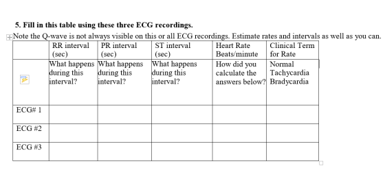 5. Fill in this table using these three ECG recordings. +Note the Q-wave is not always visible on this or all ECG recordings.