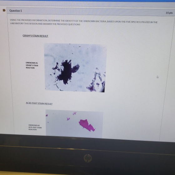 Question 1 15 pts USING THE PROVIDED INFORMATION, DETERMINE THE IDENTITY OF THE UNKNOWN BACTERIA BASED UPON THE FIVE SPECIES
