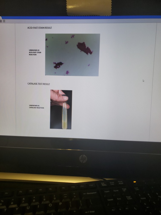 ACID-FAST STAIN RESULT UNKNOWN #1 ACID-FAST STAIN REACTION CATALASE TEST RESULT UNKNOWN 21 CATALASE REACTION
