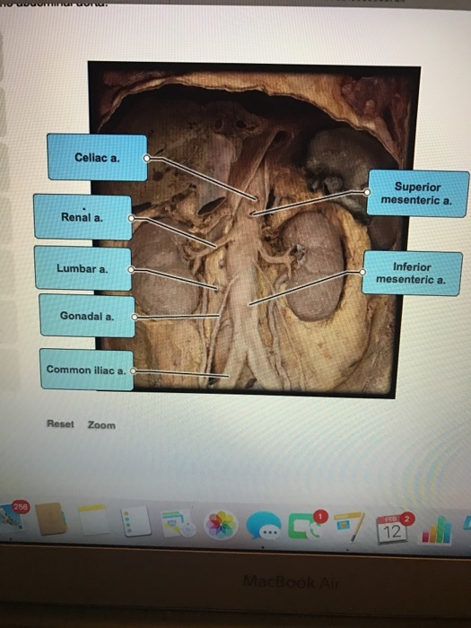 Celiac a. Renal a. Lumbar a. Gonadal a. Common iliac a. Reset Zoom Superior mesenteric a Inferior mesenteric a.