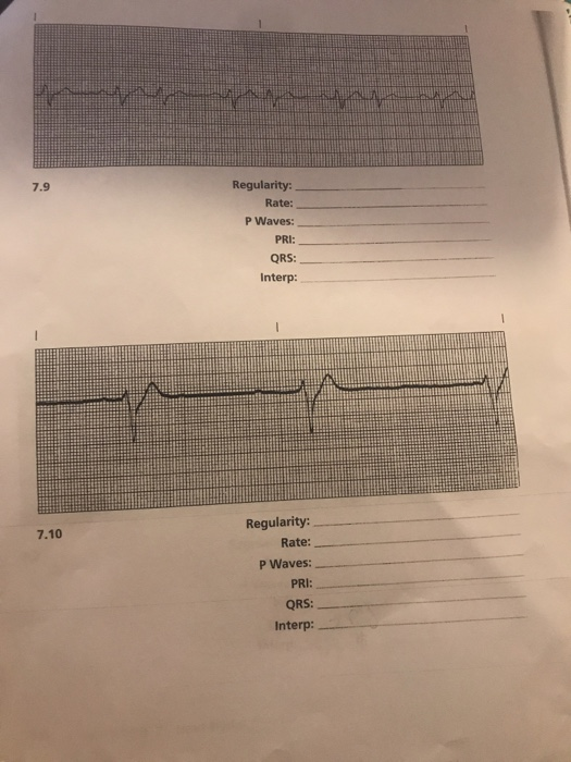 7.9 Regularity: Rate: P Waves: PRI: QRS: Interp: 7.10 Regularity: Rate: P Waves: PRI: QRS: Interp: