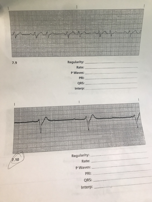 7.9 Regularity: Rate: P Waves: PRI: QRS: Interp: Regularity: Rate: P Waves: PRI: QRS: Interp: