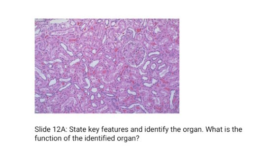 Slide 12A: State key features and identify the organ. What is the function of the identified organ?