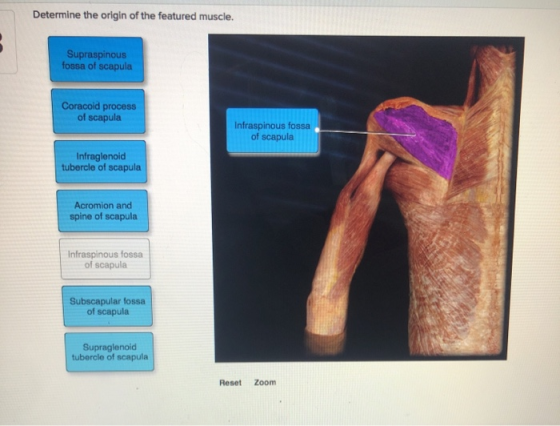Determine the origin of the featured muscle. Supraspinous fossa of scapula Coracoid process of scapula Infraspinous fossa of