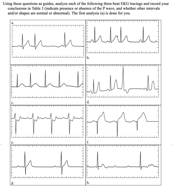 Using these questions as guides, analyze each of the following three-beat EKG tracings and record your conclusions in Table 3