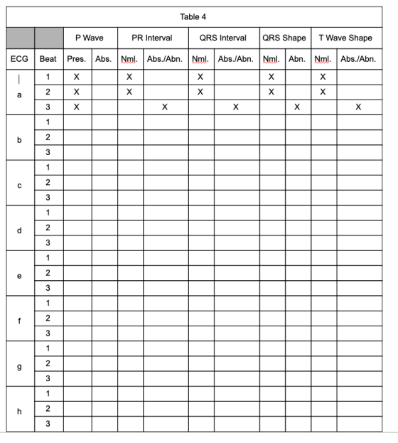 Table 4 P Wave PR Interval QRS Interval QRS Shape T Wave Shape ECG Beat Pres. Abs. Nm. Abs./Abn. Nml. Abs./Abn. Nml. Abn. Nm.