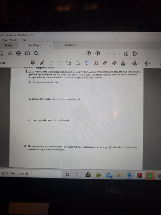 -pdf - Adobe Acrobat Reader DC View Window Help Tools Lab#8.pdf Lab#7.pdf ment T T To T. TO 2. C4. 1. A 50-year-old man was p