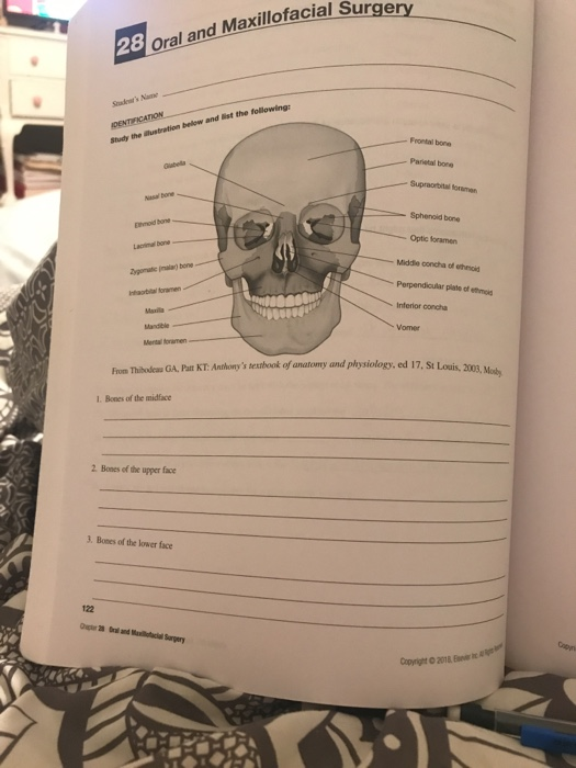 28 Oral and Maxillofacial Surge the following: IDENTIFICATION Study the station below and - Frontal bone Paritalborg Suport f