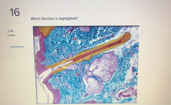 16 Which structure is highlighted? 3.44 points References