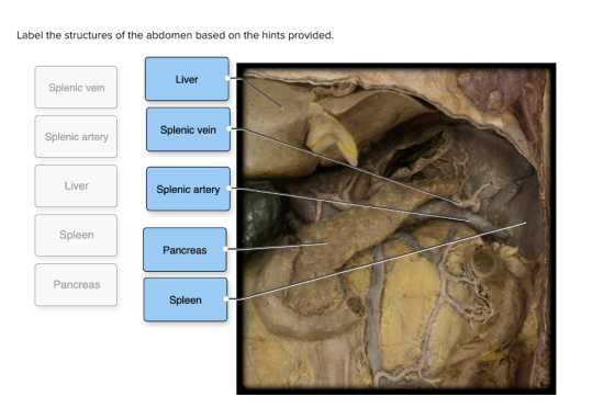 Label the structures of the abdomen based on the hints provided. Liver Splenic vein Splenic vein Splenic artery Liver Splenic