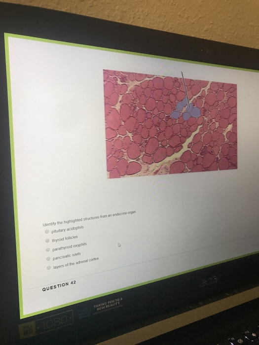 Identify the highlighted structures from an endocrine organ pituitary acidophis thyroid folicies parathyroid oxyphils pancrea